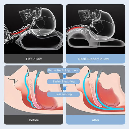 Restora™  Cervical Relief Memory Pillow